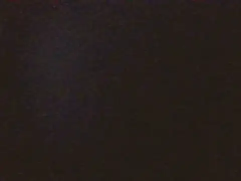 GermanxMD live
